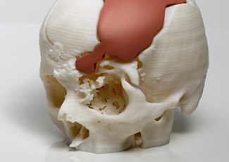 3D Printing Teknolojisi 3D Printing Teknolojisi